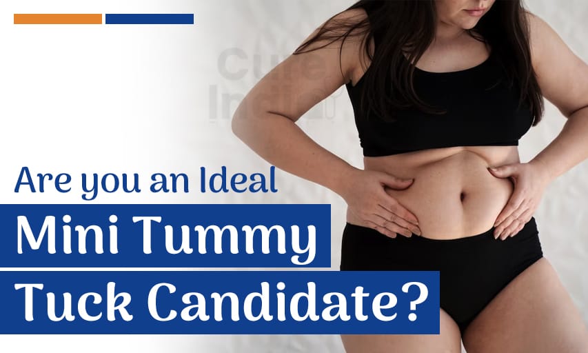 Am I a Candidate for a Tummy Tuck?
