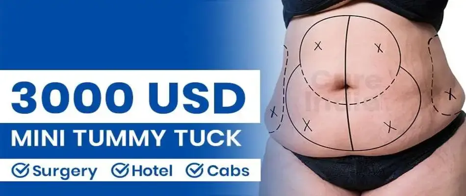 https://www.cureindia.com/images/uploads/treatments/banner/1687867817_Mini%20tummy%20tuck%20Surgery%20ost%20in%20India%20banner.webp